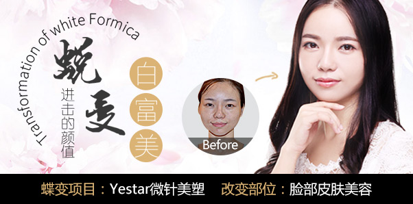 林敏皮肤美容案例