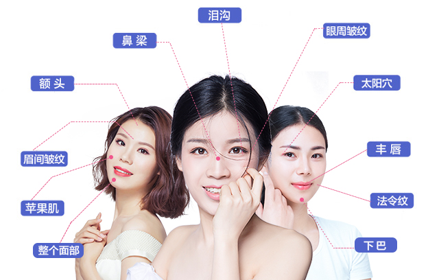 玻尿酸综合_长沙艺星医疗美容医院